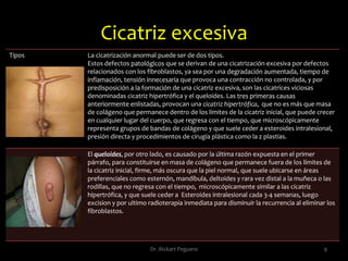 Fases de la cicatrización 5Dr. Rickart Peguero