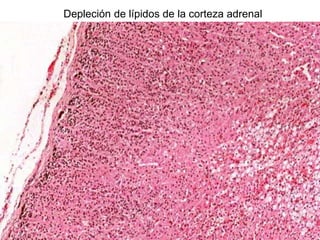 Depleción de lípidos de la corteza adrenal
 
