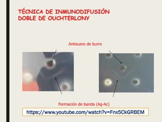 Antisuero de burro
Formación de banda (Ag-Ac)
TÉCNICA DE INMUNODIFUSIÓN
DOBLE DE OUCHTERLONY
https://www.youtube.com/watch?v=Fnx5CkGRBEM
 