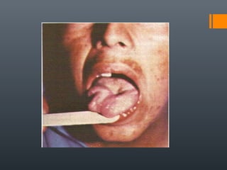 Tema V - Pares Craneales