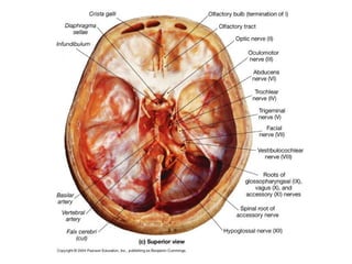 Tema V - Pares Craneales