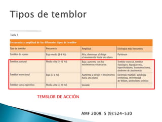 AMF 2009; 5 (9):524-530
TEMBLOR DE ACCIÓN
 