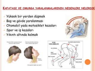 KAFATASI VE OMURGA YARALANMALARININ NEDENLERI NELERDIR?
 Yüksek bir yerden düşmek
 Baş ve gövde yaralanması
 Otomobil yada motosiklet kazaları
 Spor ve iş kazaları
 Yıkıntı altında kalmak
 