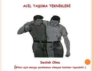 ACİL TAŞIMA TEKNİKLERİ
Destek Olma
(Bilinci açık omurga yaralanması olmayan hastalar taşınabilir.)
 