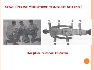 SEDYE ÜZERINE YERLEŞTIRME TEKNIKLERI NELERDIR?
Karşılıklı Durarak Kaldırma
 