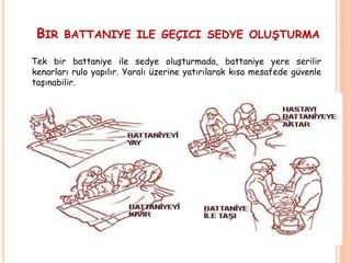 BIR BATTANIYE ILE GEÇICI SEDYE OLUŞTURMA
Tek bir battaniye ile sedye oluşturmada, battaniye yere serilir
kenarları rulo yapılır. Yaralı üzerine yatırılarak kısa mesafede güvenle
taşınabilir.
 