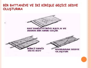 BİR BATTANİYE VE İKİ KİRİŞLE GEÇİCİ SEDYE
OLUŞTURMA
 