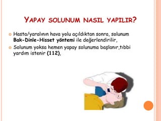 YAPAY SOLUNUM NASIL YAPILIR?
 Hasta/yaralının hava yolu açıldıktan sonra, solunum
Bak-Dinle-Hisset yöntemi ile değerlendirilir,
 Solunum yoksa hemen yapay solunuma başlanır,tıbbi
yardım istenir (112),
 