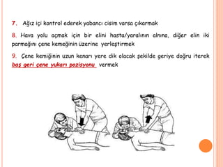 7. Ağız içi kontrol ederek yabancı cisim varsa çıkarmak
8. Hava yolu açmak için bir elini hasta/yaralının alnına, diğer elin iki
parmağını çene kemeğinin üzerine yerleştirmek
9. Çene kemiğinin uzun kenarı yere dik olacak şekilde geriye doğru iterek
baş geri çene yukarı pozisyonu vermek
 