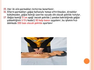 15. Her iki elin parmakları birbirine kenetlenir,
16. Ellerin parmakları göğüs kafesiyle temas ettirilmeden, dirsekler
bükülmeden, göğüs kemiği üzerine vücuda dik olacak şekilde tutulur,
17. Göğüs kemiği 5 cm aşağı inecek şekilde ( yandan bakıldığında göğüs
yüksekliğinin 1/3’ü kadar) 30 kalp basısı uygulanır, bu işlemin hızı
dakikada 100 bası olacak şekilde ayarlanır
 