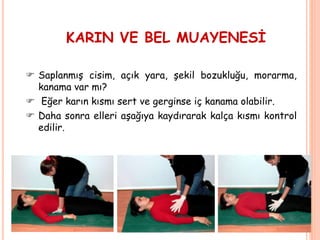 KARIN VE BEL MUAYENESİ
 Saplanmış cisim, açık yara, şekil bozukluğu, morarma,
kanama var mı?
 Eğer karın kısmı sert ve gerginse iç kanama olabilir.
 Daha sonra elleri aşağıya kaydırarak kalça kısmı kontrol
edilir.
 