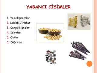 YABANCI CİSİMLER
1. Yemek parçaları
2. Leblebi / Nohut
3. Çengelli iğneler
4. Kolyeler
5. Çiviler
6. Düğmeler
 
