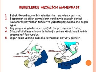 BEBEKLERDE HEİMLİCH MANEVRASI
1. Bebek ilkyardımcının bir kolu üzerine ters olarak yatırılır,
2. Başparmak ve diğer parmakların yardımıyla bebeğin çenesi
kavranarak boynundan tutulur ve yüzüstü pozisyonda öne doğru
eğilir,
3. Baş gergin ve gövdesinden aşağıda bir pozisyonda tutulur,
4. 5 kez el bileğinin iç kısmı ile bebeğin sırtına kürek kemiklerinin
arasına hafifçe vurulur,
5. Diğer kolun üzerine başı elle kavranarak sırtüstü çevrilir,
 