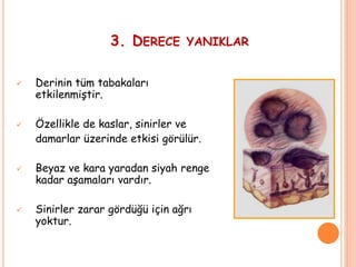 3. DERECE YANIKLAR
 Derinin tüm tabakaları
etkilenmiştir.
 Özellikle de kaslar, sinirler ve
damarlar üzerinde etkisi görülür.
 Beyaz ve kara yaradan siyah renge
kadar aşamaları vardır.
 Sinirler zarar gördüğü için ağrı
yoktur.
 