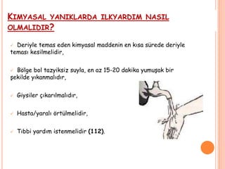 KIMYASAL YANIKLARDA ILKYARDIM NASIL
OLMALIDIR?
 Deriyle temas eden kimyasal maddenin en kısa sürede deriyle
teması kesilmelidir,
 Bölge bol tazyiksiz suyla, en az 15-20 dakika yumuşak bir
şekilde yıkanmalıdır,
 Giysiler çıkarılmalıdır,
 Hasta/yaralı örtülmelidir,
 Tıbbi yardım istenmelidir (112).
 