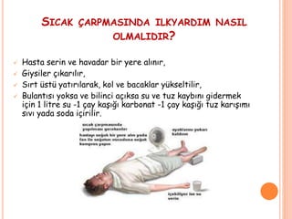 SICAK ÇARPMASINDA ILKYARDIM NASIL
OLMALIDIR?
 Hasta serin ve havadar bir yere alınır,
 Giysiler çıkarılır,
 Sırt üstü yatırılarak, kol ve bacaklar yükseltilir,
 Bulantısı yoksa ve bilinci açıksa su ve tuz kaybını gidermek
için 1 litre su -1 çay kaşığı karbonat -1 çay kaşığı tuz karışımı
sıvı yada soda içirilir.
 