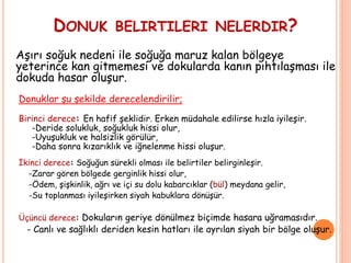DONUK BELIRTILERI NELERDIR?
Aşırı soğuk nedeni ile soğuğa maruz kalan bölgeye
yeterince kan gitmemesi ve dokularda kanın pıhtılaşması ile
dokuda hasar oluşur.
Donuklar şu şekilde derecelendirilir;
Birinci derece: En hafif şeklidir. Erken müdahale edilirse hızla iyileşir.
-Deride solukluk, soğukluk hissi olur,
-Uyuşukluk ve halsizlik görülür,
-Daha sonra kızarıklık ve iğnelenme hissi oluşur.
İkinci derece: Soğuğun sürekli olması ile belirtiler belirginleşir.
-Zarar gören bölgede gerginlik hissi olur,
-Ödem, şişkinlik, ağrı ve içi su dolu kabarcıklar (bül) meydana gelir,
-Su toplanması iyileşirken siyah kabuklara dönüşür.
Üçüncü derece: Dokuların geriye dönülmez biçimde hasara uğramasıdır.
- Canlı ve sağlıklı deriden kesin hatları ile ayrılan siyah bir bölge oluşur.
 