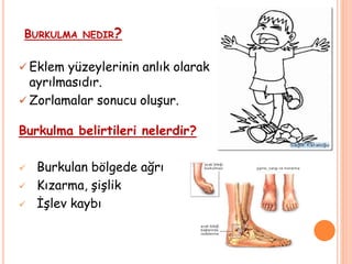 BURKULMA NEDIR?
 Eklem yüzeylerinin anlık olarak
ayrılmasıdır.
 Zorlamalar sonucu oluşur.
Burkulma belirtileri nelerdir?
 Burkulan bölgede ağrı
 Kızarma, şişlik
 İşlev kaybı
 