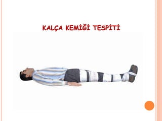 KALÇA KEMİĞİ TESPİTİ
 