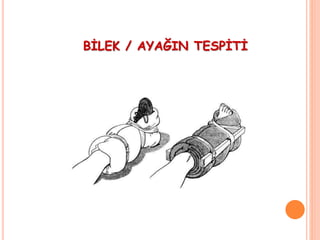 BİLEK / AYAĞIN TESPİTİ
 