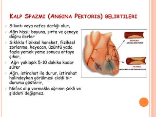 KALP SPAZMI (ANGINA PEKTORIS) BELIRTILERI
 Sıkıntı veya nefes darlığı olur,
 Ağrı hissi; boyuna, sırta ve çeneye
doğru ilerler
 Sıklıkla fiziksel hareket, fiziksel
zorlanma, heyecan, üzüntü yada
fazla yemek yeme sonucu ortaya
çıkar,
 Ağrı yaklaşık 5-10 dakika kadar
sürer
 Ağrı, istirahat ile durur, istirahat
halindeyken görülmesi ciddi bir
durumu gösterir,
 Nefes alıp vermekle ağrının şekli ve
şiddeti değişmez.
 
