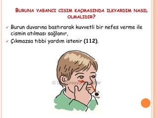 BURUNA YABANCI CISIM KAÇMASINDA ILKYARDIM NASIL
OLMALIDIR?
 Burun duvarına bastırarak kuvvetli bir nefes verme ile
cismin atılması sağlanır,
 Çıkmazsa tıbbi yardım istenir (112).
 