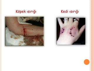 Köpek ısırığı Kedi ısırığı
 