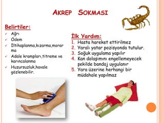 AKREP SOKMASI
Belirtiler:
 Ağrı
 Ödem
 İltihaplanma,kızarma,morar
ma
 Adale krampları,titreme ve
karıncalanma
 Huzursuzluk,havale
gözlenebilir.
İlk Yardım:
1. Hasta hareket ettirilmez
2. Yaralı yatar pozisyonda tutulur.
3. Soğuk uygulama yapılır
4. Kan dolaşımını engellemeyecek
şekilde bandaj uygulanır
5. Yara üzerine herhangi bir
müdahale yapılmaz
 