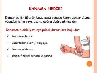 KANAMA NEDİR?
Damar bütünlüğünün bozulması sonucu kanın damar dışına
vücudun içine veya dışına doğru doğru akmasıdır.
Kanamanın ciddiyeti aşağıdaki durumlara bağlıdır;
 Kanamanın hızına,
 Vücutta kanın aktığı bölgeye,
 Kanama miktarına,
 Kişinin fiziksel durumu ve yaşına.
 