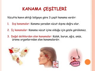KANAMA ÇEŞİTLERİ
Vücutta kanın aktığı bölgeye göre 3 çeşit kanama vardır:
1. Dış kanamalar: Kanama yaradan vücut dışına doğru olur.
2. İç kanamalar: Kanama vücut içine olduğu için gözle görülemez.
3. Doğal deliklerden olan kanamalar: Kulak, burun, ağız, anüs,
üreme organlarından olan kanamalardır.
 