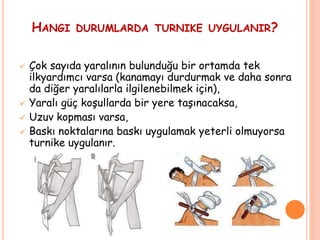 HANGI DURUMLARDA TURNIKE UYGULANIR?
 Çok sayıda yaralının bulunduğu bir ortamda tek
ilkyardımcı varsa (kanamayı durdurmak ve daha sonra
da diğer yaralılarla ilgilenebilmek için),
 Yaralı güç koşullarda bir yere taşınacaksa,
 Uzuv kopması varsa,
 Baskı noktalarına baskı uygulamak yeterli olmuyorsa
turnike uygulanır.
 
