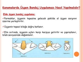 Kanamalarda Üçgen Bandaj Uygulaması Nasıl Yapılmalıdır?
Elde üçgen bandaj uygulama:
Parmaklar, üçgenin tepesine gelecek şekilde el üçgen sargının
üzerine yerleştirilir.
Üçgenin tepesi bileğe doğru katlanır.
Elin sırtında, üçgenin uçları karşı karşıya getirilir ve çaprazlanır,
bilek seviyesinde düğümlenir.
 