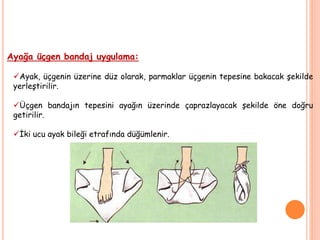 Ayağa üçgen bandaj uygulama:
Ayak, üçgenin üzerine düz olarak, parmaklar üçgenin tepesine bakacak şekilde
yerleştirilir.
Üçgen bandajın tepesini ayağın üzerinde çaprazlayacak şekilde öne doğru
getirilir.
İki ucu ayak bileği etrafında düğümlenir.
 