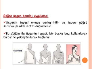 Göğse üçgen bandaj uygulama:
Üçgenin tepesi omuza yerleştirilir ve tabanı göğsü
saracak şekilde sırtta düğümlenir.
Bu düğüm ile üçgenin tepesi, bir başka bez kullanılarak
birbirine yaklaştırılarak bağlanır.
 