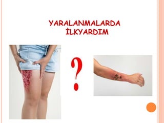 YARALANMALARDA
İLKYARDIM
 