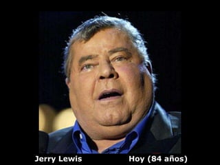 Jerry Lewis   Hoy (84 años)
 