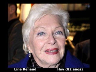 Line Renaud   Hoy (82 años)
 