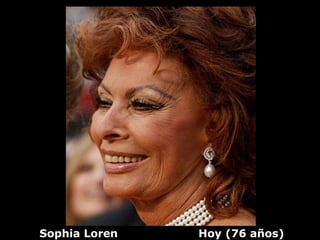 Sophia Loren   Hoy (76 años)
 