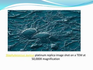 Staphylococcus aureus platinum replica image shot on a TEM at
                   50,000X magnification
 