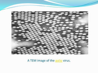 A TEM image of the polio virus.
 