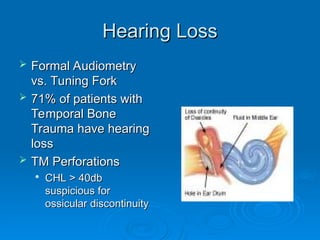 Hearing Loss
Hearing Loss
 Formal Audiometry
Formal Audiometry
vs. Tuning Fork
vs. Tuning Fork
 71% of patients with
71% of patients with
Temporal Bone
Temporal Bone
Trauma have hearing
Trauma have hearing
loss
loss
 TM Perforations
TM Perforations

CHL > 40db
CHL > 40db
suspicious for
suspicious for
ossicular discontinuity
ossicular discontinuity
 