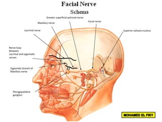 Superior	salivary	nucleus	
Facial	nerve	
Greater	superﬁcial	petrosal	nerve	
Pterygopala<ne		
ganglion	
Maxillary	nerve	
Lacrimal	nerve	
Zygoma<c	branch	of	
Maxillary	nerve	
Nerve	loop	
Between	
Lacrimal	and	zygoma<c	
nerves	
 