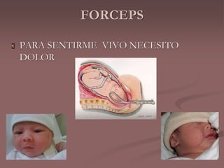FORCEPS 
 PARA SENTIRME VIVO NECESITO 
DOLOR 
 