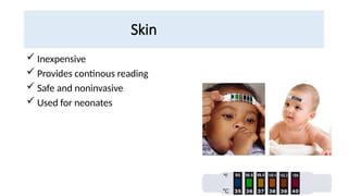 Skin
 Inexpensive
 Provides continous reading
 Safe and noninvasive
 Used for neonates
 