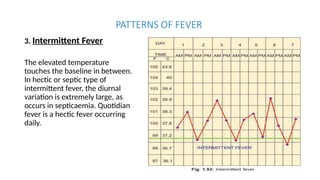 Comprehensive Overview of Body Temperature Regulation and Fever ...