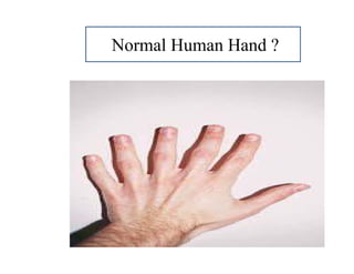 Normal Human Hand ?
 
