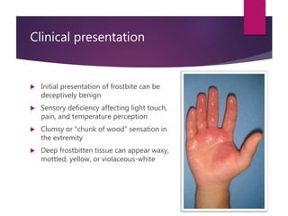 Clinical presentation
 Initial presentation of frostbite can be
deceptively benign
 Sensory deficiency affecting light touch,
pain, and temperature perception
 Clumsy or “chunk of wood” sensation in
the extremity
 Deep frostbitten tissue can appear waxy,
mottled, yellow, or violaceous-white
 
