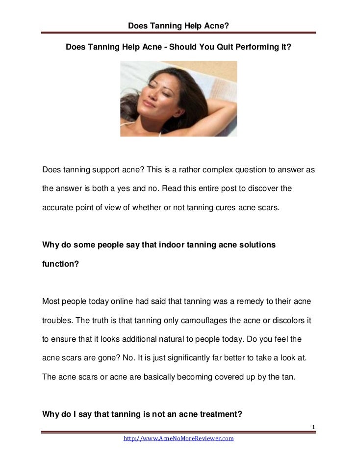 Does Tanning Help Acne Should You Quit Performing It?