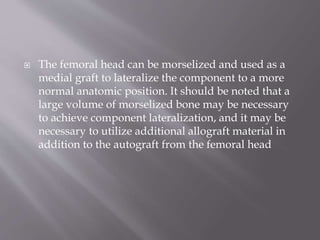 Templating X-rays in THR | PPTX