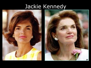 Jackie Kennedy 
